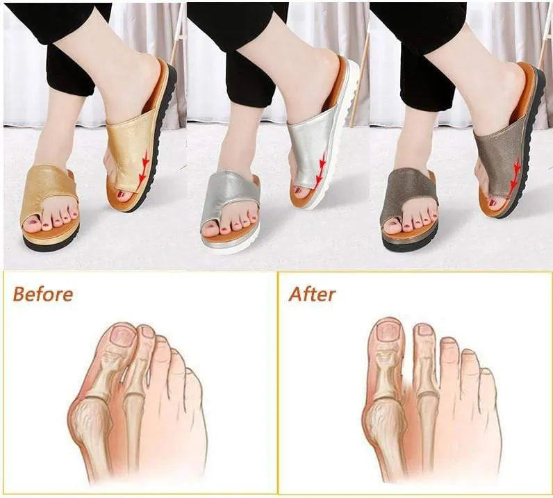 Bunion Correction Sandals