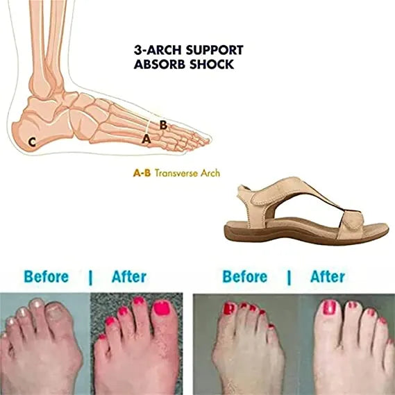 Comfortable Women's Velcro Wedge Orthopedic Sandals